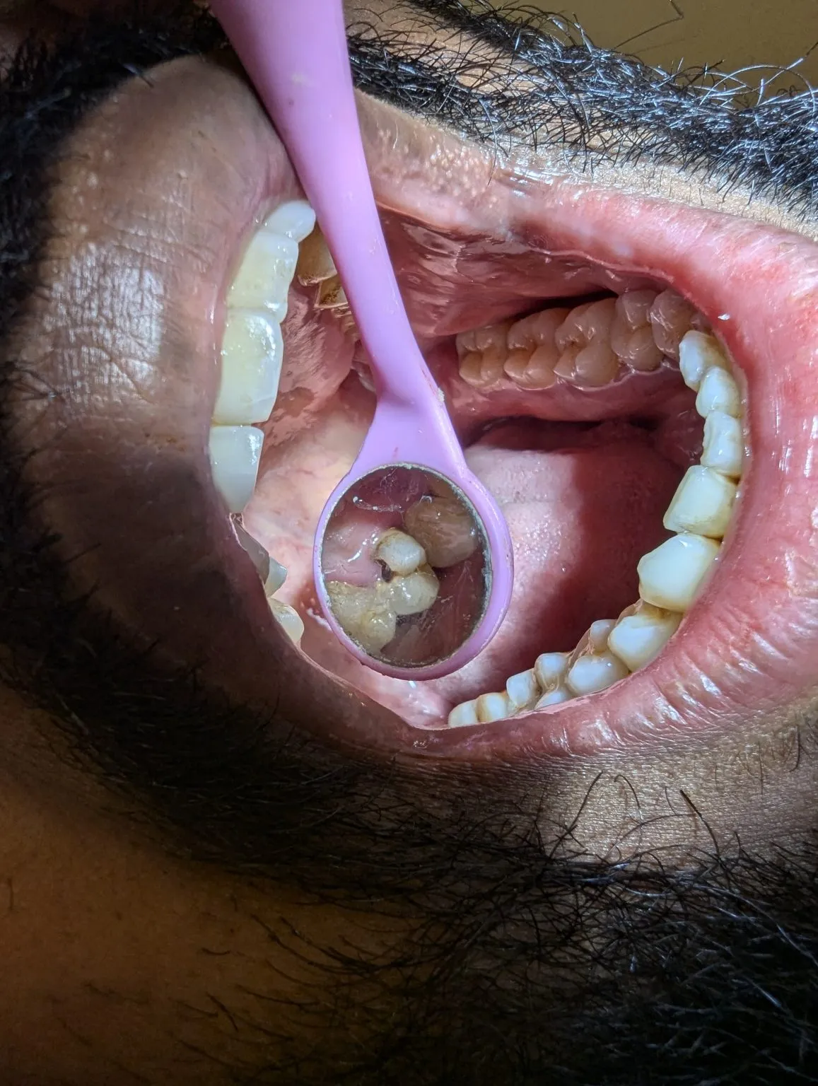 PXL_20241031_110159138.MP_-1157x1536