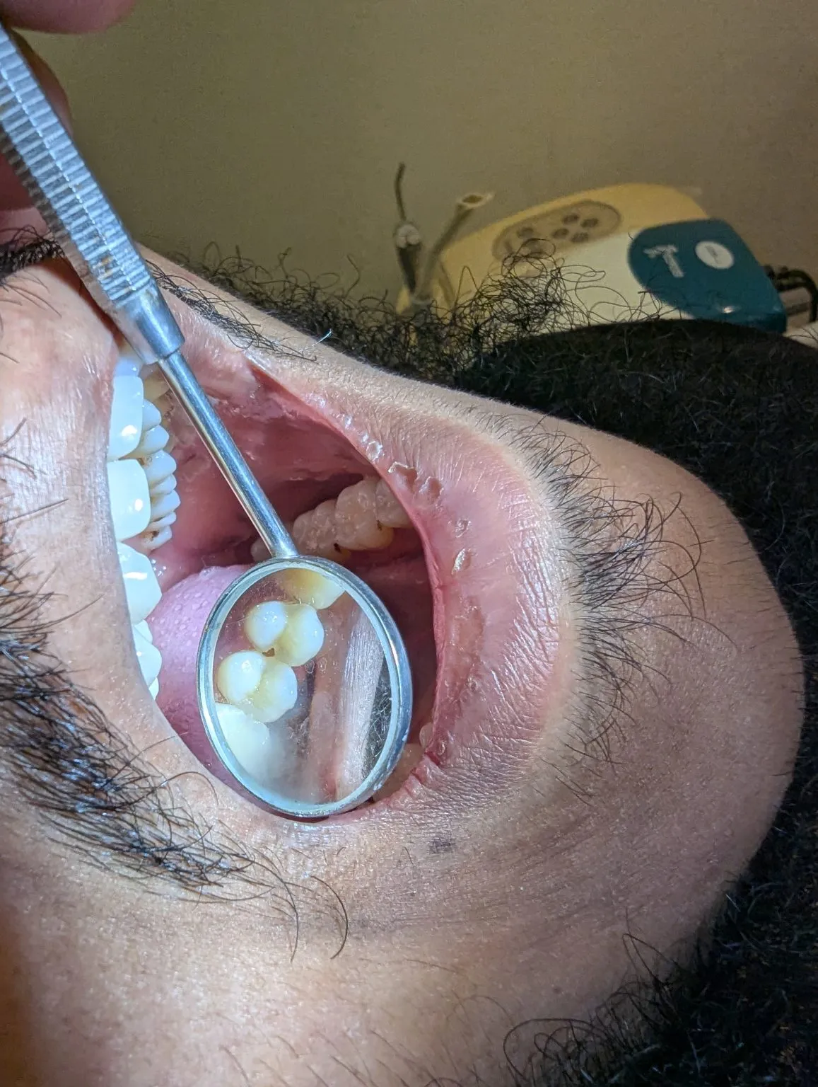 PXL_20241124_103935159.MP_-1157x1536