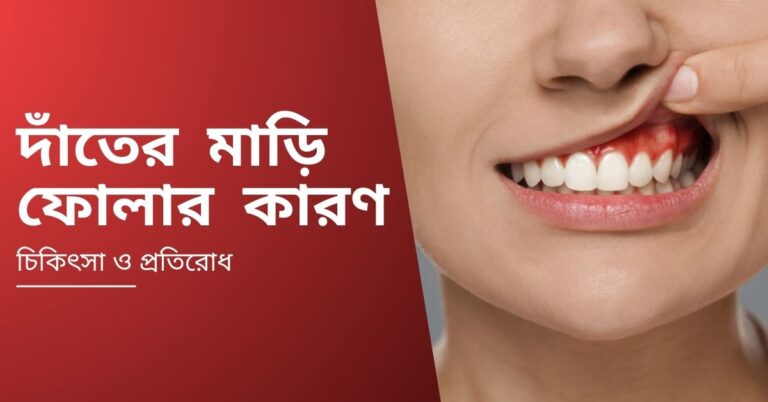 দাঁতের মাড়ি ফোলার কারণ – চিকিৎসা ও প্রতিরোধ